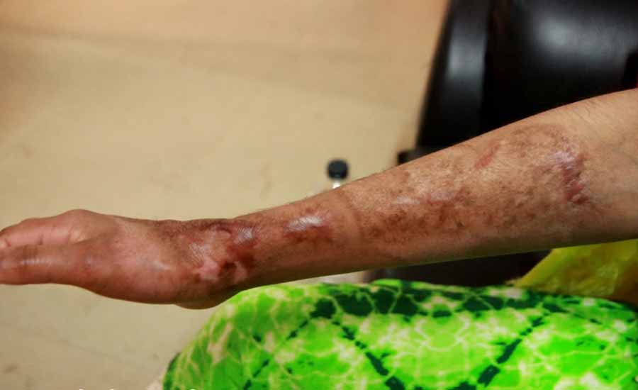 ময়মনসিংহে নির্যাতনের শিকার গৃহকর্মীর চিকিৎসার দায়িত্ব নিলেন পুলিশ সুপার