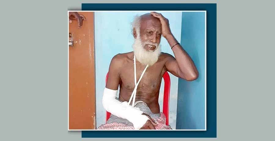 নেত্রকোনায় বাবাকে পিটিয়ে হাত ভেঙে দেয়ার অভিযোগ ছেলের বিরুদ্ধে