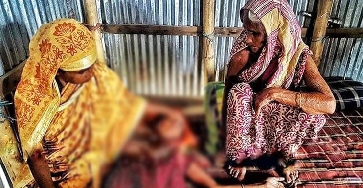 ভুয়া চিকিৎসার শিকার হলেন শেফালি বেগম