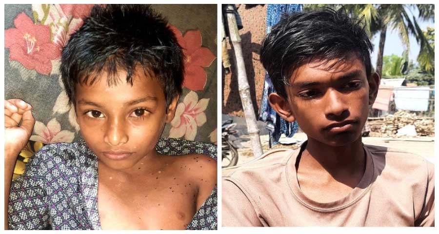 ময়মনসিংহে শিশু তফাজ্জল ও শুভর চিকিৎসার নির্দেশ দিলেন পুলিশ সুপার