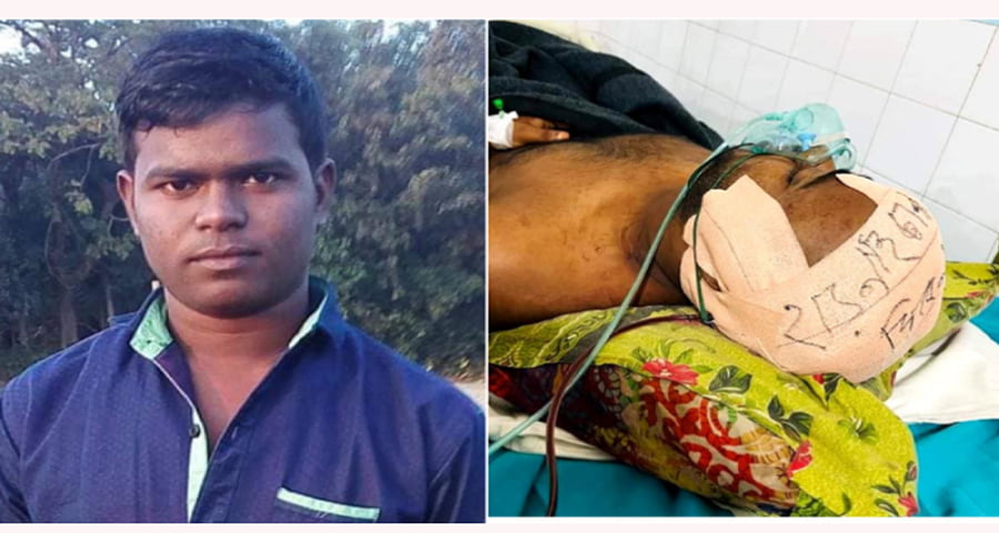 নান্দাইলের আরশাদুল ঢাকা মেডিক্যালে, মাথার মগজ সাভারে