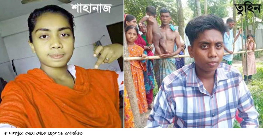 জামালপুরে এক মেয়ের শারীরিক পরিবর্তন এসে ছেলেতে রূপান্তরিত