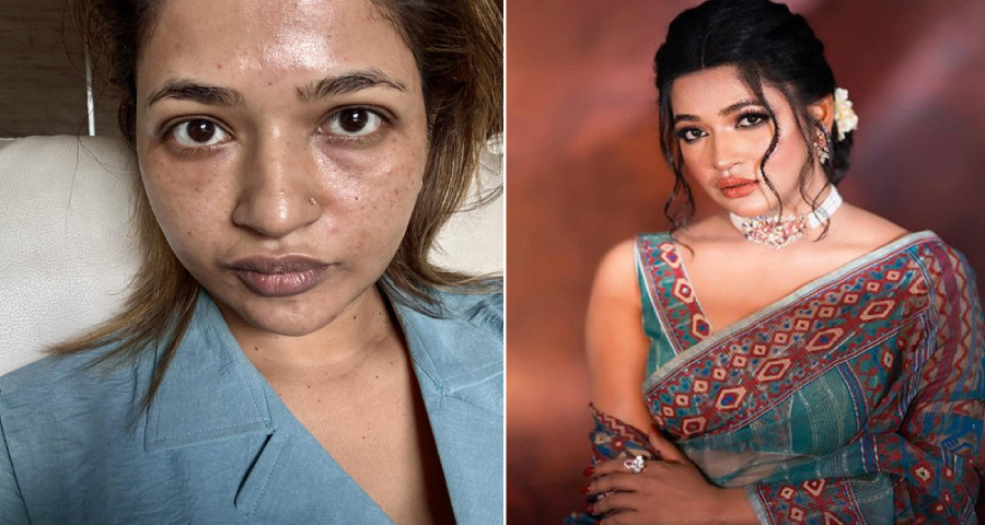 আমি অনেক ‘ট্রমা’ বয়ে বেড়াই : বাঁধন