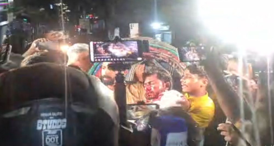 আহত নুরুল হক নুর আইসিইউতে