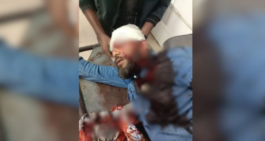 এবার এনসিপির খুলনা বিভাগীয় প্রধানের মাথায় গুলি